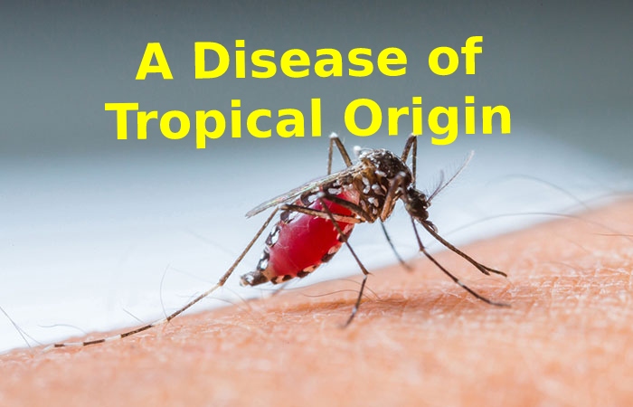 A Disease of Tropical Origin Dengue Fever