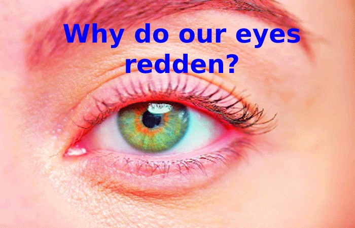 Why do our eyes redden_ Red Eyes