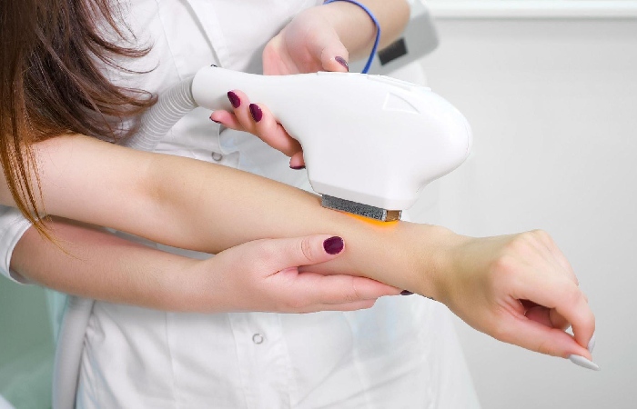 The Pros and Cons of Laser Hair Removal for Hand 