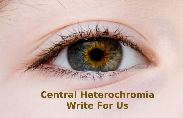 Central Heterochromia Write For Us