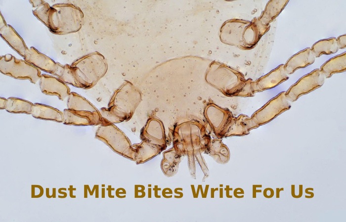 Dust Mite Bites Write For Us