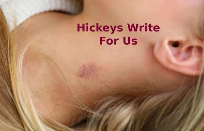 Hickeys Write For Us