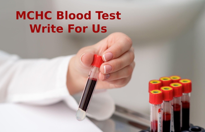 MCHC Blood Test Write For Us