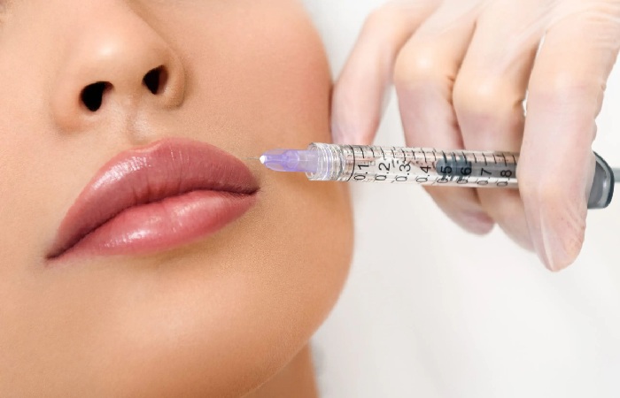 Botox Lip Flip Write For Us