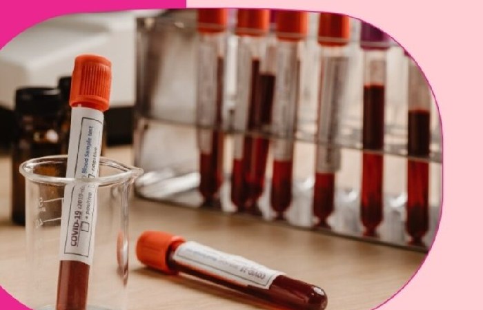 MCHC Blood Test Write For Us,