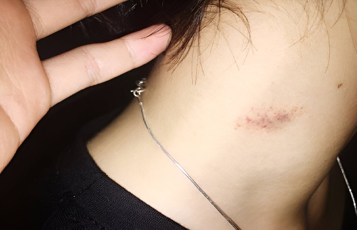 Hickeys Write For Us